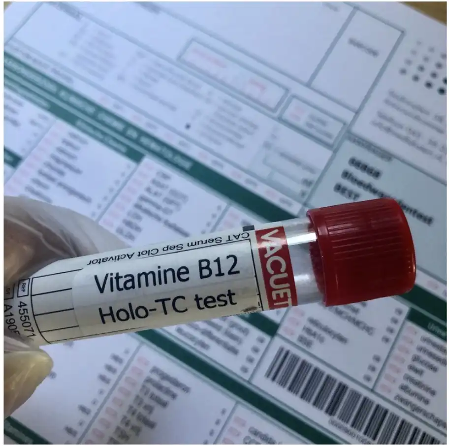 ActiefVitB12 (Holo TC) Vitamine B12 te kort test