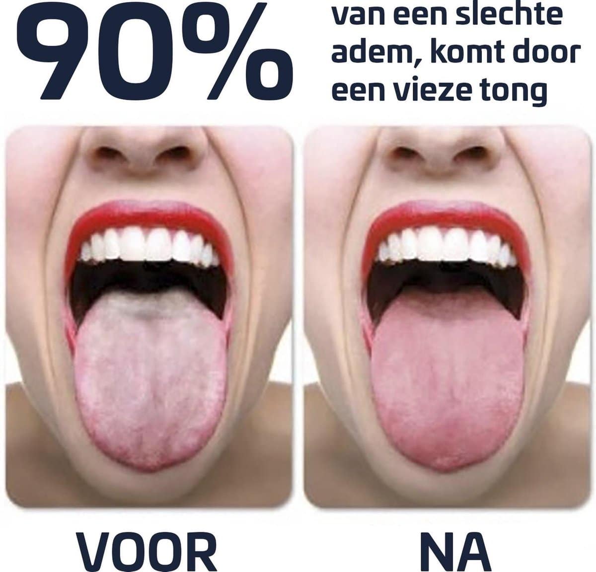 Effectieve Tongschraper Rose Goud